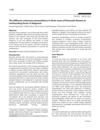 The different presentations in three cases of Kawasaki disease as confounding factor of